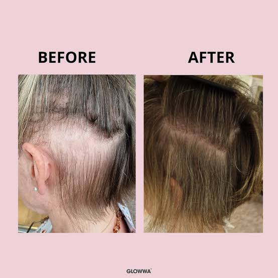 Glowwa Hair Capsules (3 month supply)