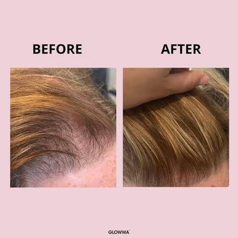 Glowwa Hair Capsules (3 month supply)